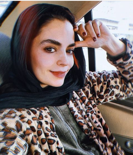 عکس سپیده خداوردی قبل از عمل زیبایی