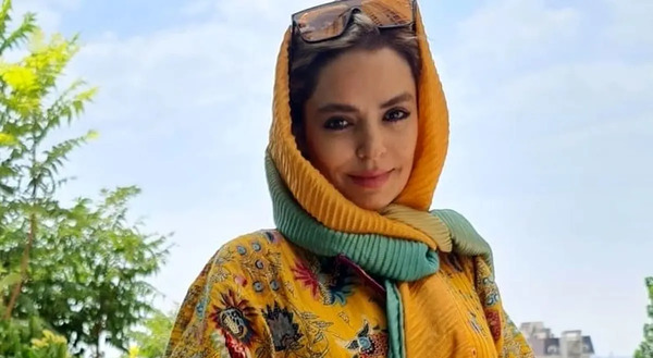 عکس سپیده خداوردی قبل از عمل زیبایی