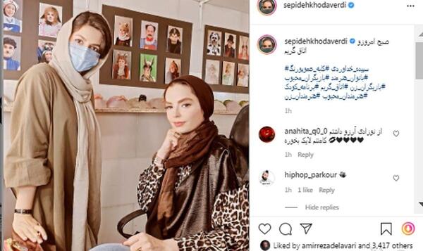 عکس سپیده خداوردی قبل از عمل زیبایی