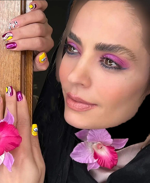 عکس سپیده خداوردی قبل از عمل زیبایی