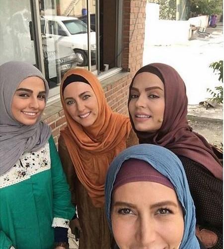 عکس سپیده خداوردی قبل از عمل زیبایی