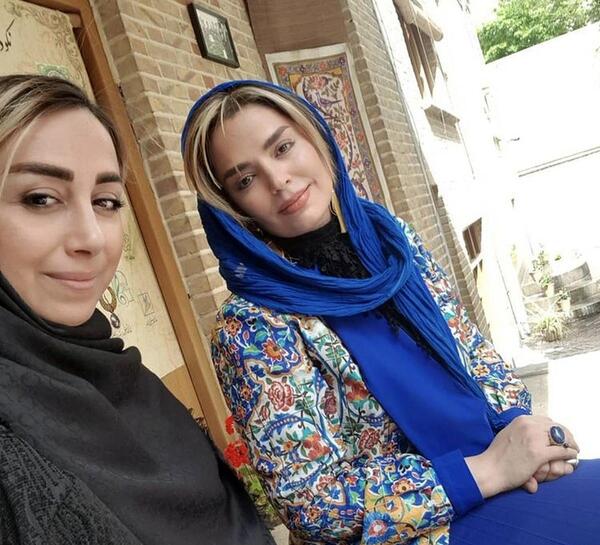 عکس سپیده خداوردی قبل از عمل زیبایی