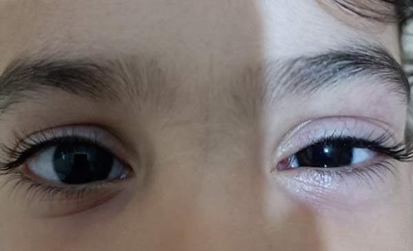 عکس چشم گریه کرده