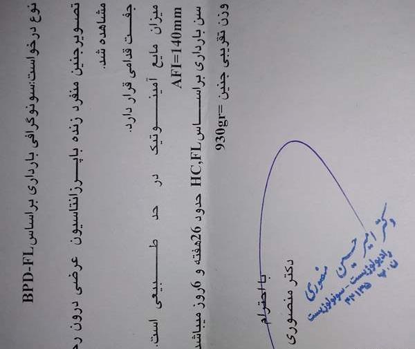 عکس جنین دختر در سونوگرافی نی نی سایت
