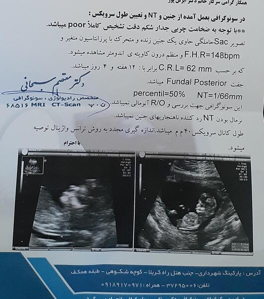عکس جنین دختر در سونوگرافی نی نی سایت