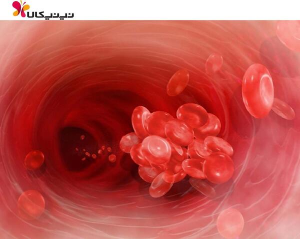عکس جنین سقط شده