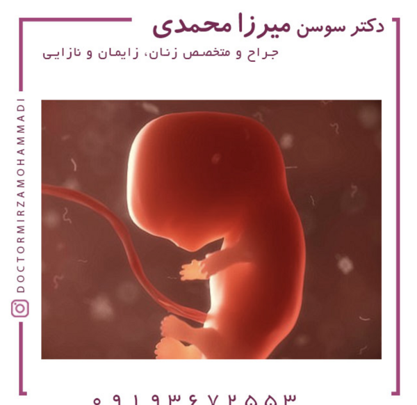 عکس جنین سقط شده