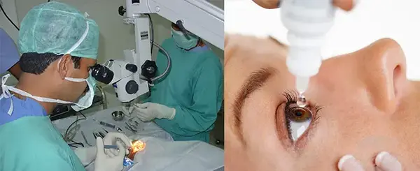 عکس عمل چشم اب مروارید