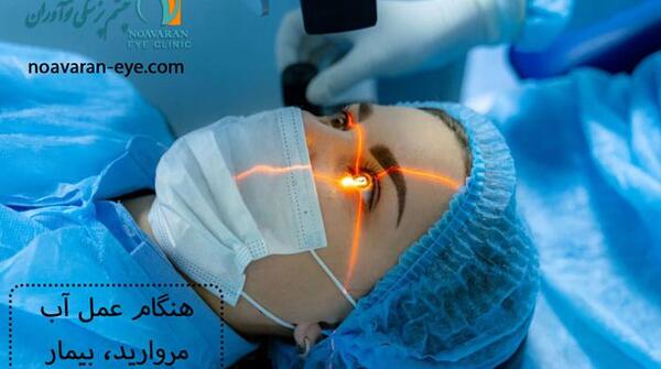 عکس عمل چشم اب مروارید