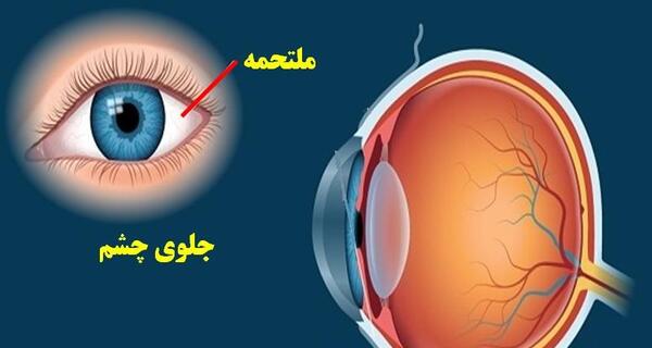 عکس چشم انسان کلاس پنجم