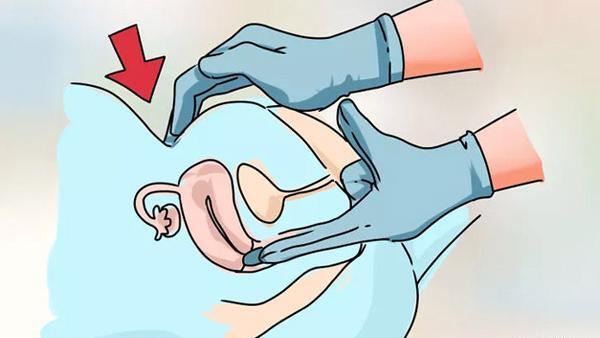عکس جنین سقط شده پنج هفته ای نی نی سایت