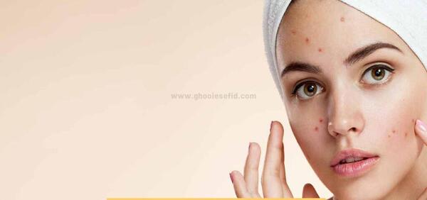 عکس انواع جوش بدن