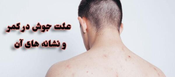 عکس انواع جوش بدن