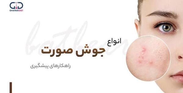 عکس انواع جوش بدن