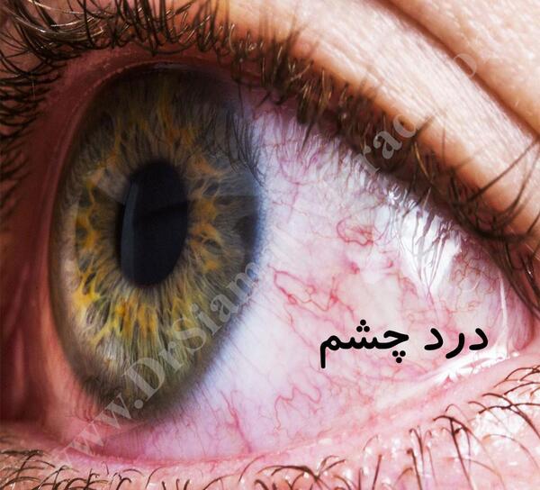 عکس چشم گل کشیده
