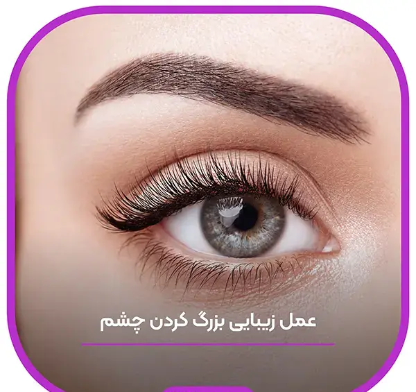 عکس عمل چشم روباهی