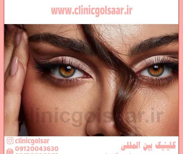 عکس عمل چشم روباهی