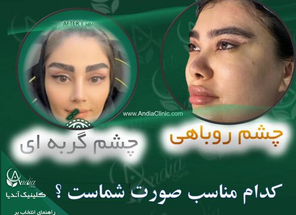 عکس عمل چشم روباهی