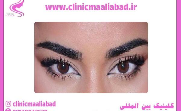 عکس عمل چشم روباهی