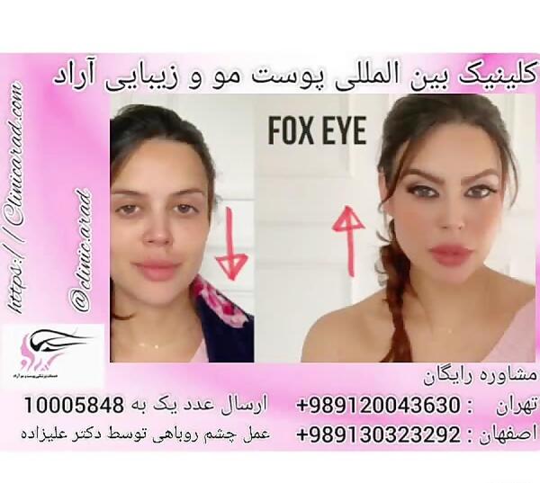 عکس عمل چشم روباهی