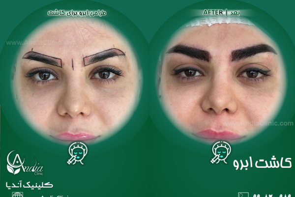 عکس عمل چشم روباهی