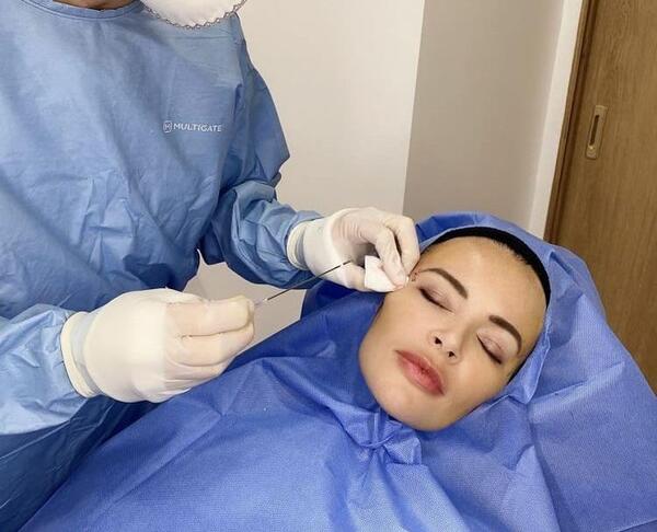 عکس عمل چشم روباهی
