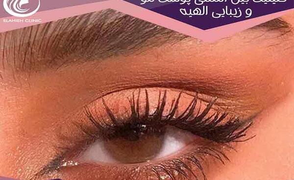 عکس عمل چشم روباهی
