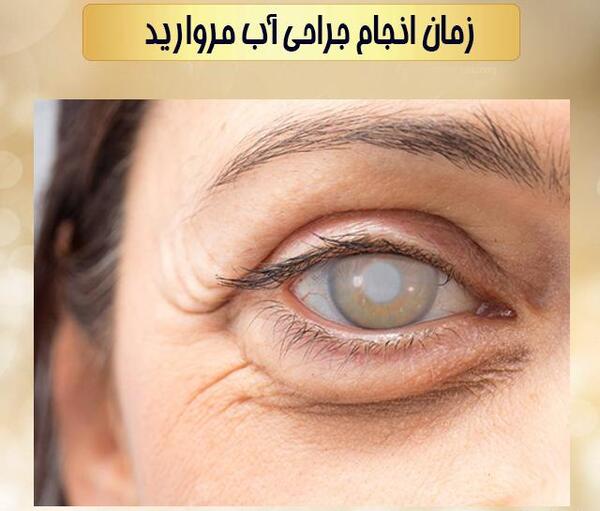 عکس چشم جراحی آب مروارید