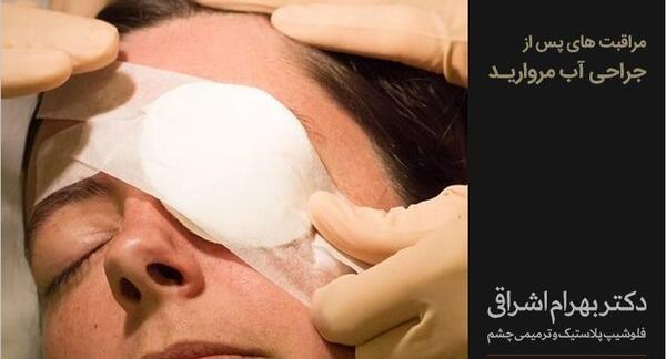 عکس چشم جراحی آب مروارید