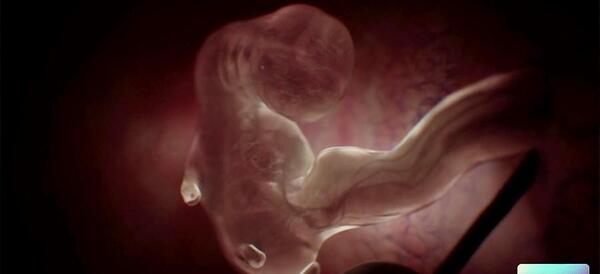 عکس جنین سقط شده شش هفته ای پسر