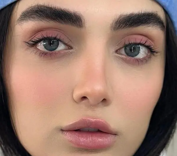 عکس لنز چشم ابی یخی