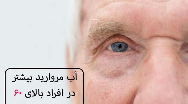 عکس چشم دارای اب مروارید