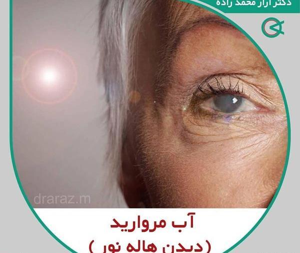 عکس چشم دارای اب مروارید