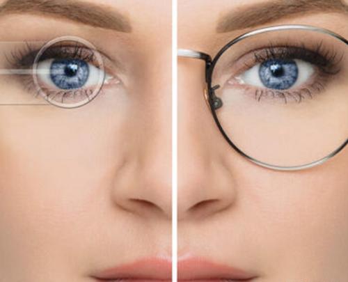 عکس های عمل لیزیک چشم