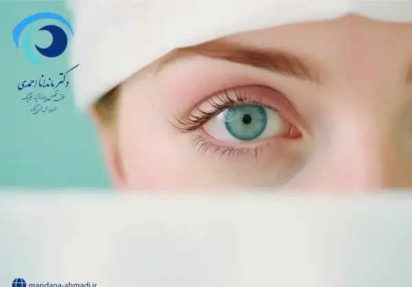 عکس های عمل لیزیک چشم
