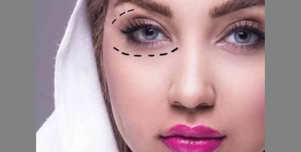 عکس دختر چشم ریز