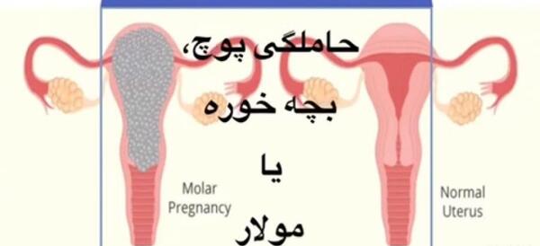 عکس بچه خوره در رحم نی نی سایت