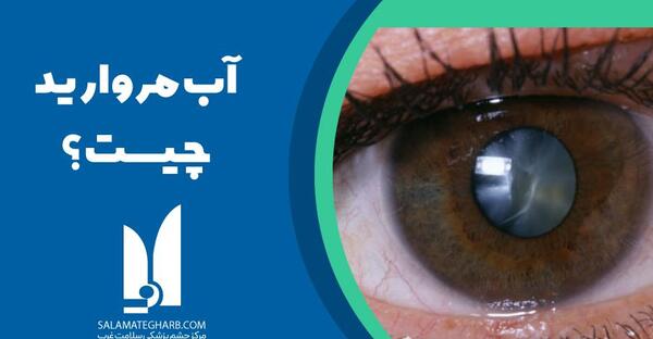 عکس بیماری آب مروارید چشم