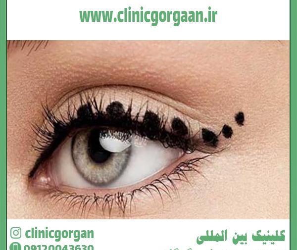 عکس چشم گربه ای بدون ارایش