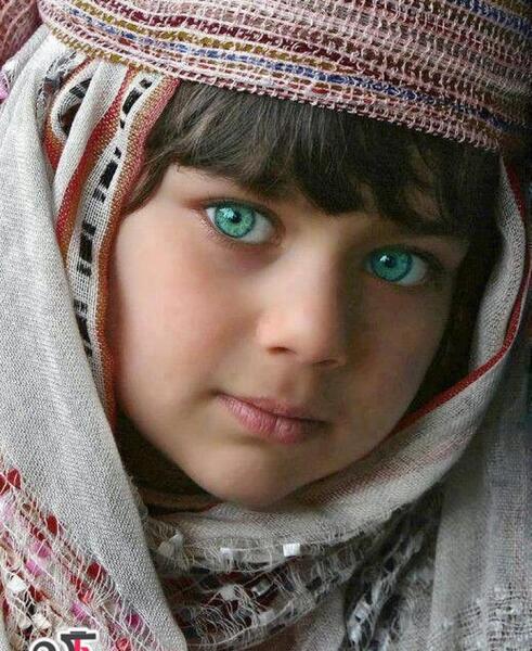 عکس چشم صورتی واقعی
