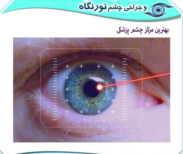 عکس چشم پزشکی نور کرج