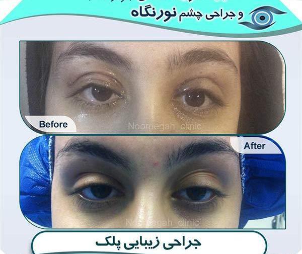 عکس چشم پزشکی نور کرج