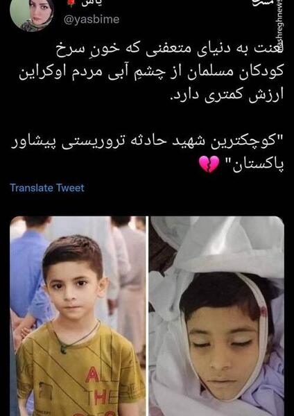 عکس کوچکترین چشم دنیا