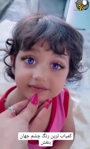 عکس کوچکترین چشم دنیا
