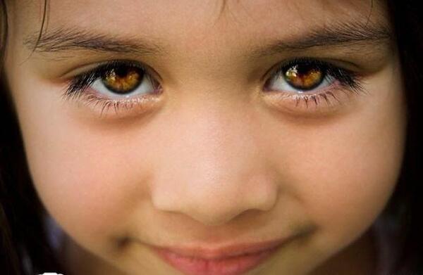 عکس کوچکترین چشم دنیا