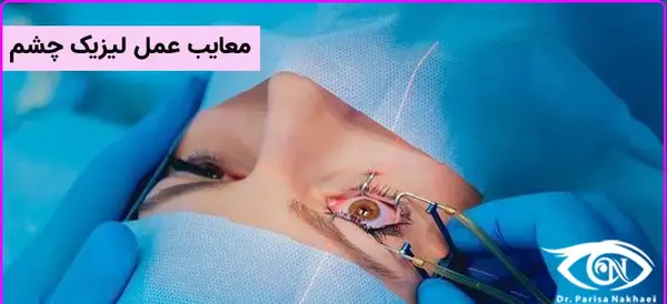عکس عمل چشم لیزیک