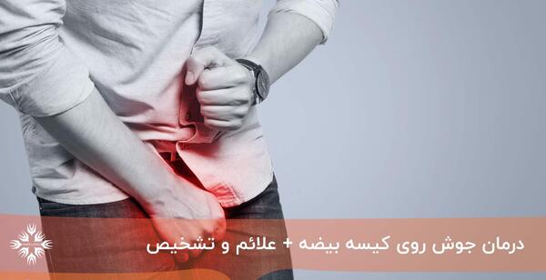 عکس جوش ناحیه تناسلی زنان درمان خانگی