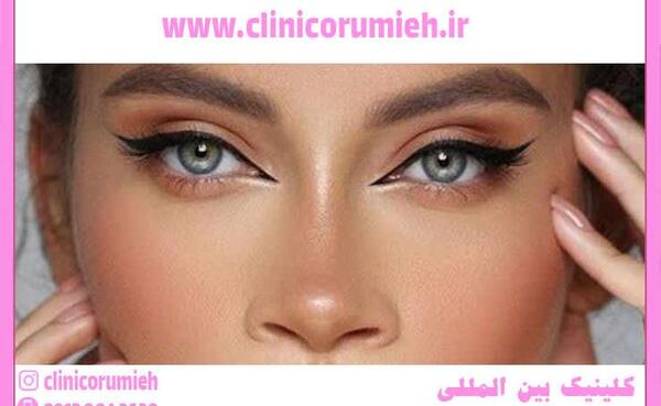 عکس چشم خماری