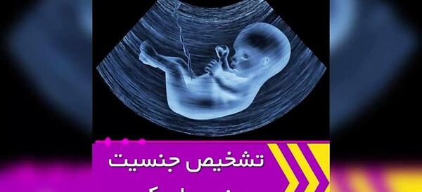 عکس تعیین جنسیت نوزاد