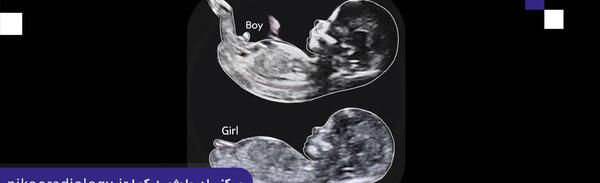عکس تعیین جنسیت نوزاد